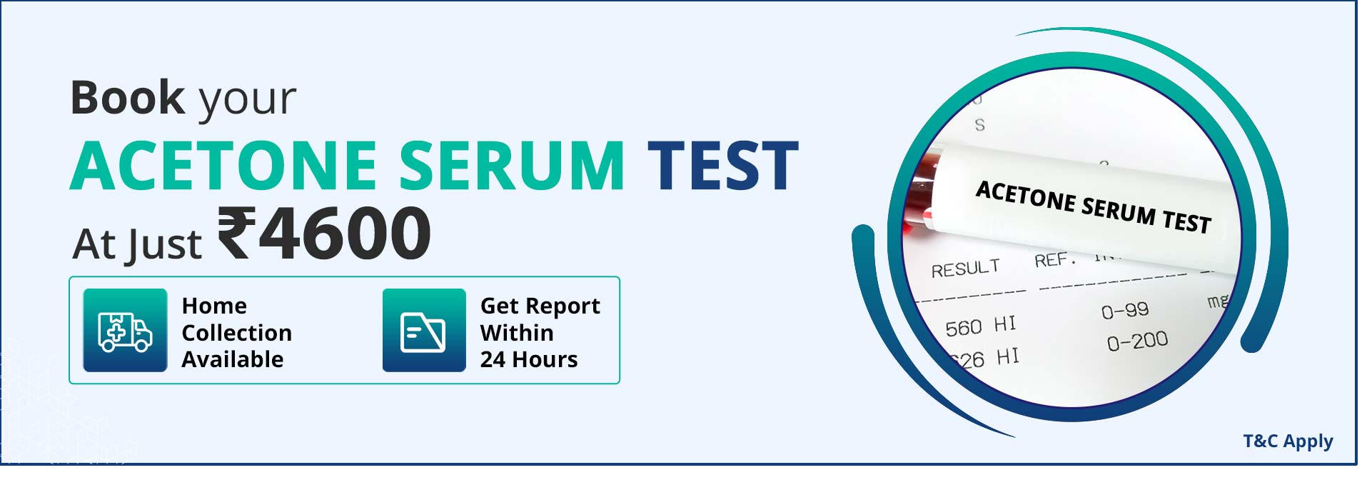 Acetone serum test