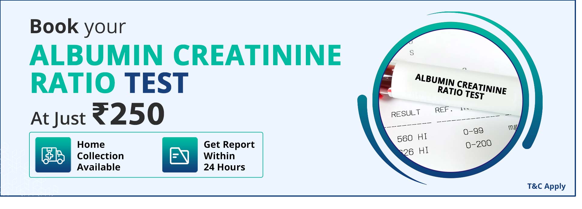 Albumin creatinine ratio test