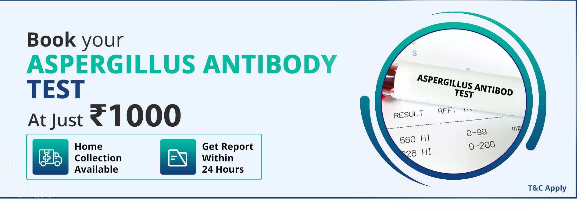 Aspergillus antibody test