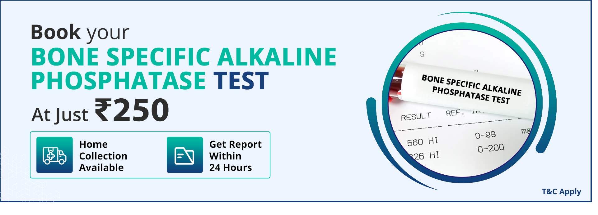 Bone specific alkaline phosphatase test