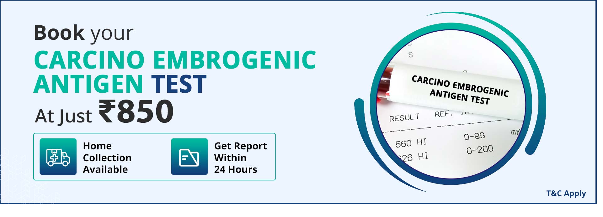 Carcino embrogenic antigen test