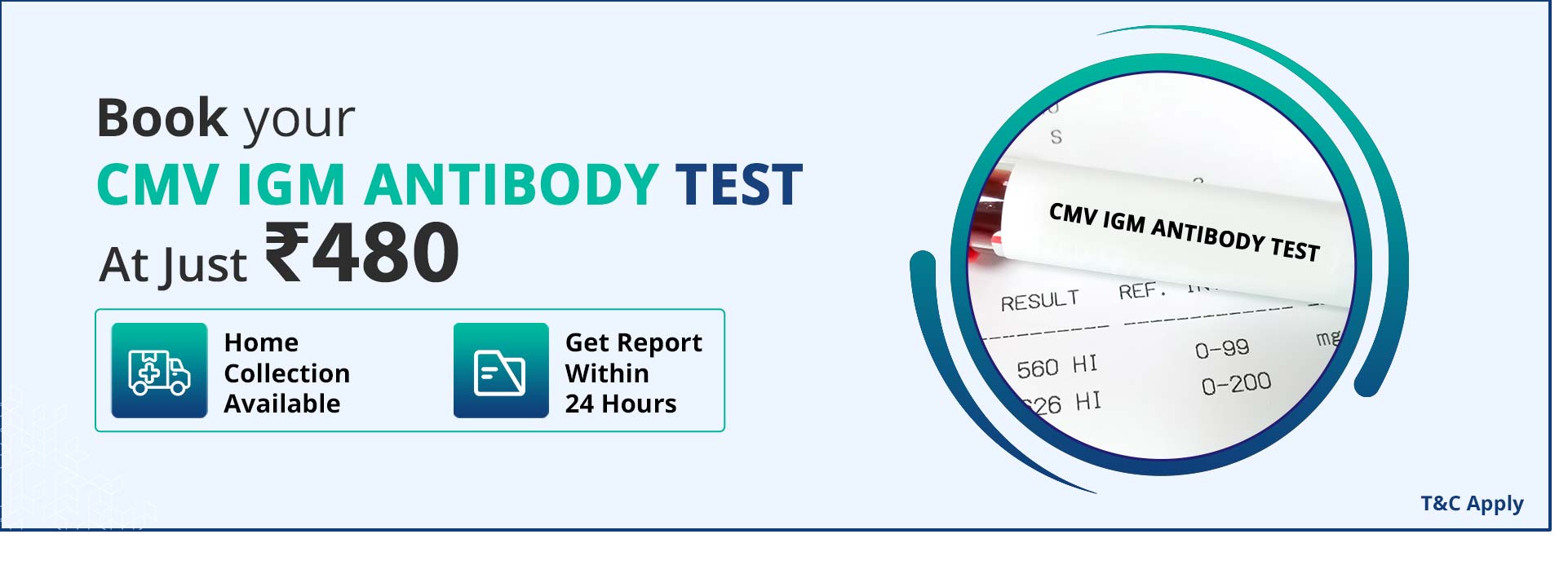 Cmv igm antibody test