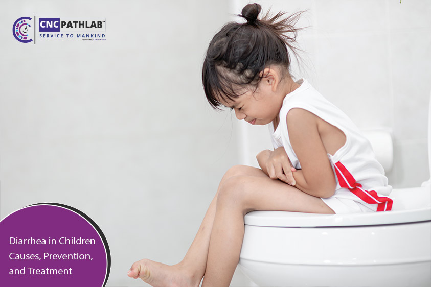 Diarrhea in Children: Causes, Prevention, and Treatment