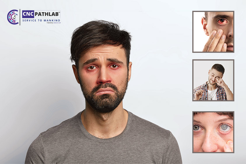 Most common symptoms of an eye stroke