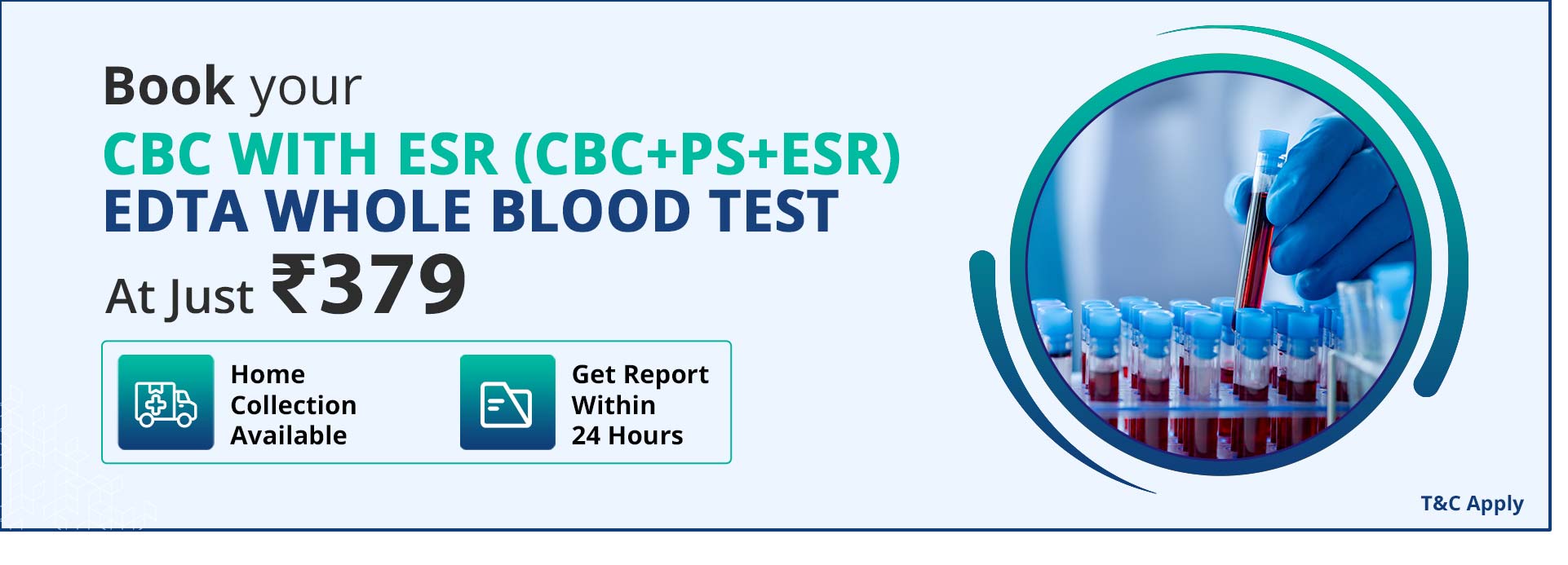 CBC with ESR (CBC+PS+ESR) EDTA Whole Blood Test
