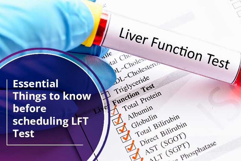 Essential things to know before scheduling LFT test