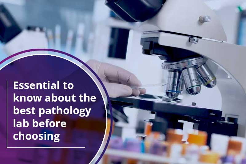 Essential to know about best pathology lab before choosing