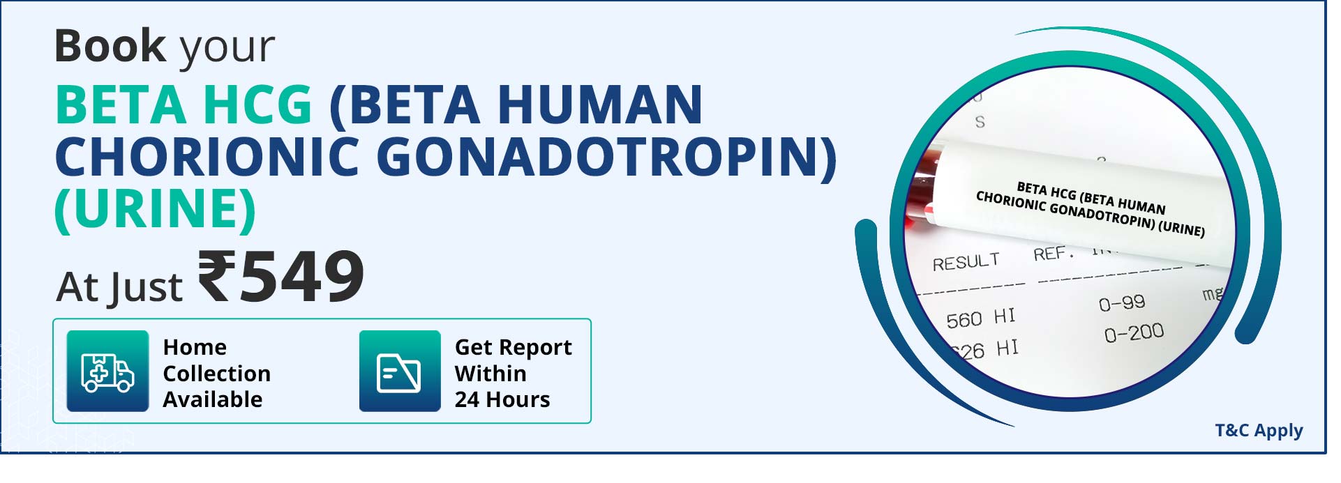 Beta HCG (Beta Human Chorionic Gonadotropin) (Urine)
