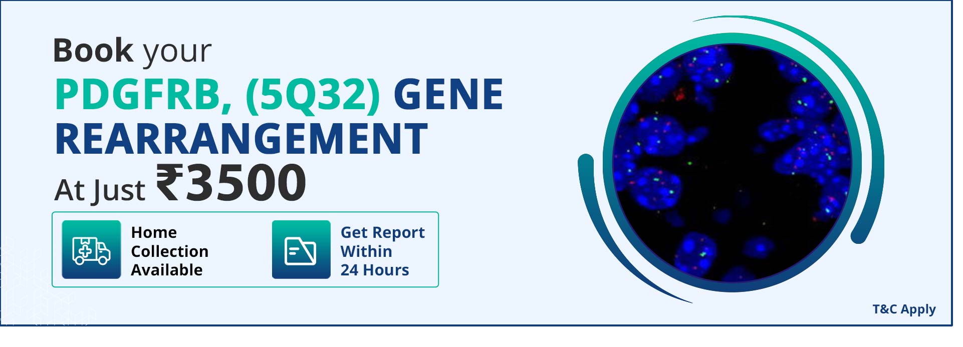 PDGFRB,(5q32) GeneRearrangement